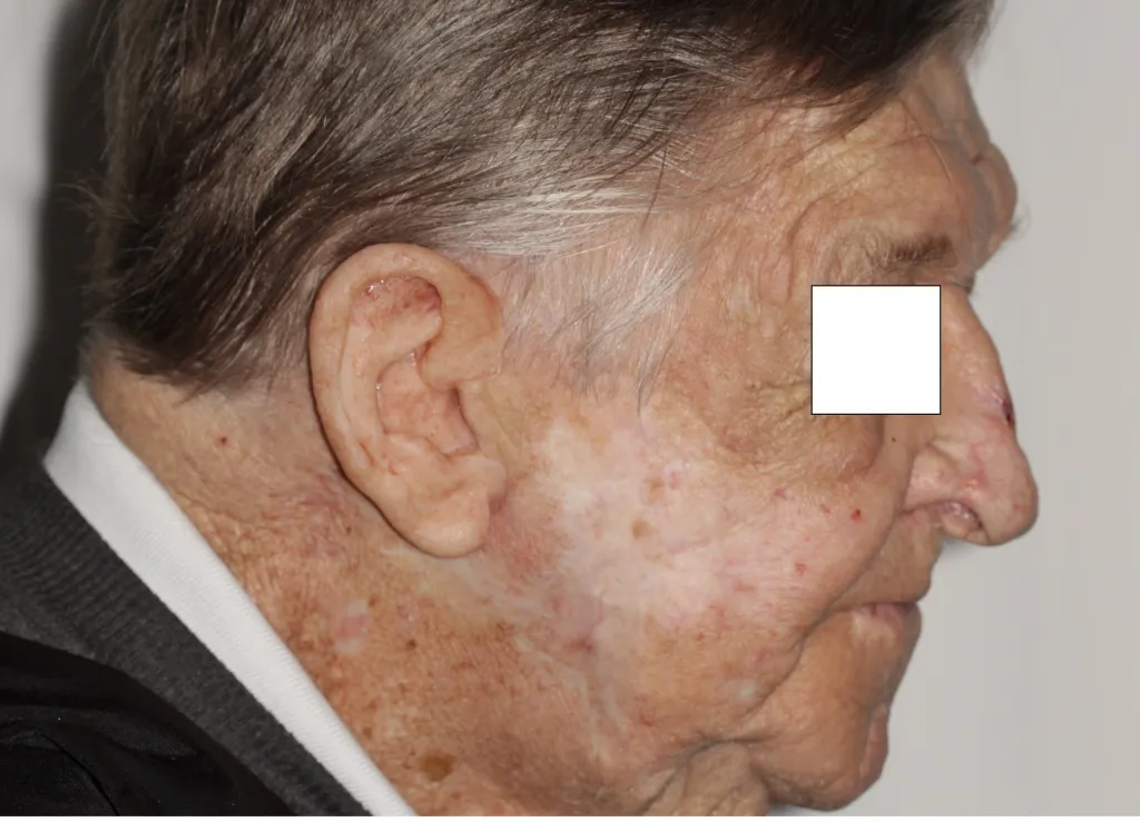 Before and After image