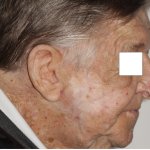 Before and After image