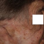 Before and After image