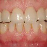 Before and After image