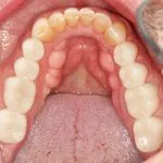 Before and After image