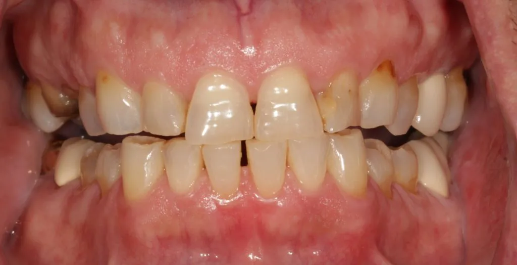 Before and After image