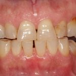 Before and After image