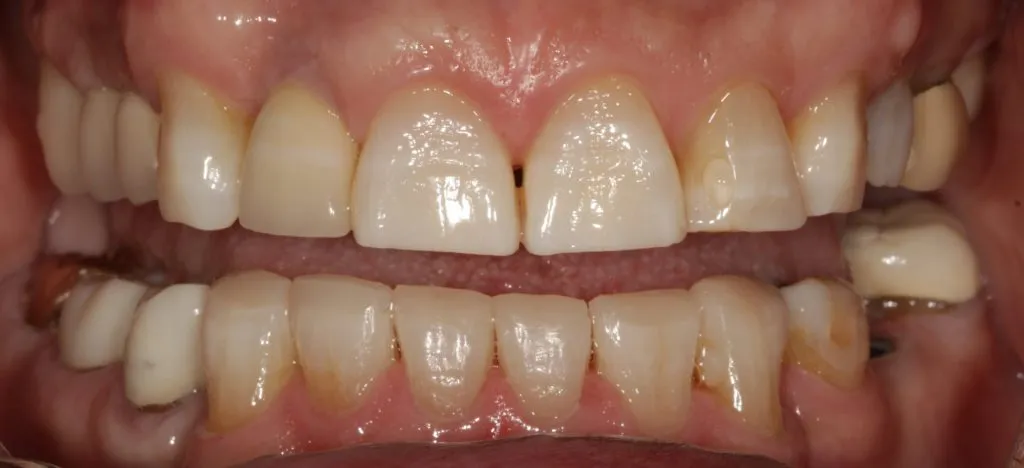 Before and After image