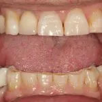 Before and After image