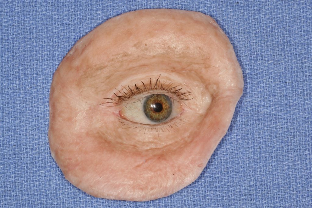 Before and After image