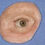 Before and After image