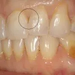 Before and After image
