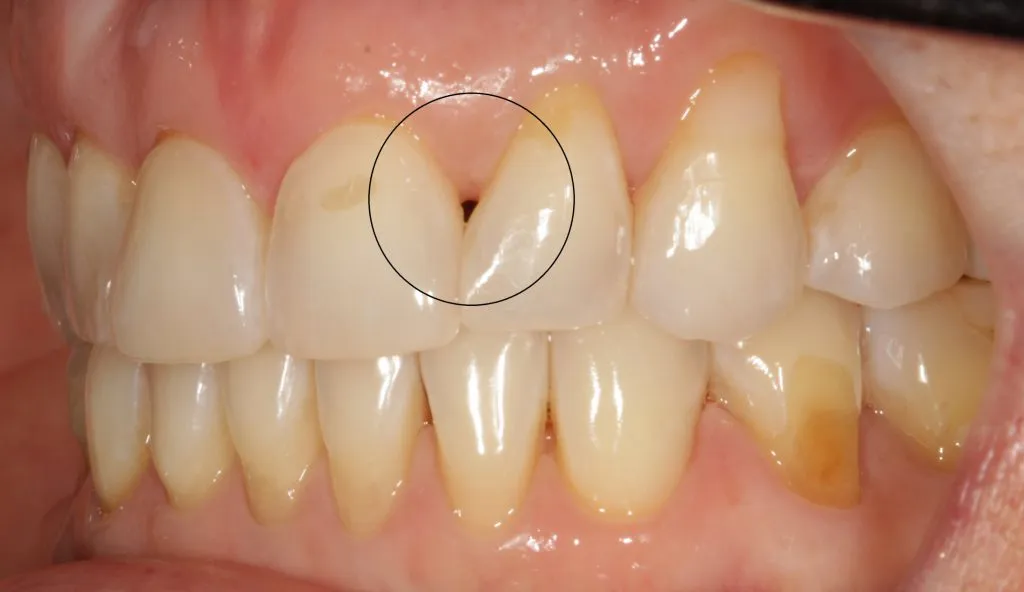 Before and After image