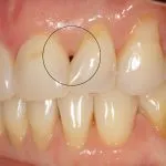 Before and After image